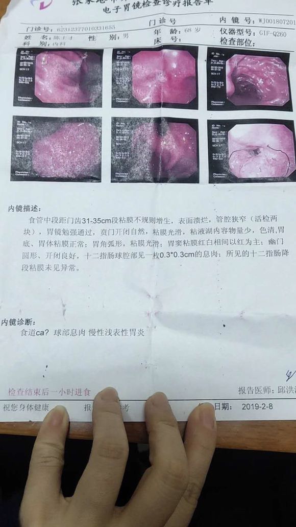 父亲检查结果出来到今天我都一直瞒着他们老两口