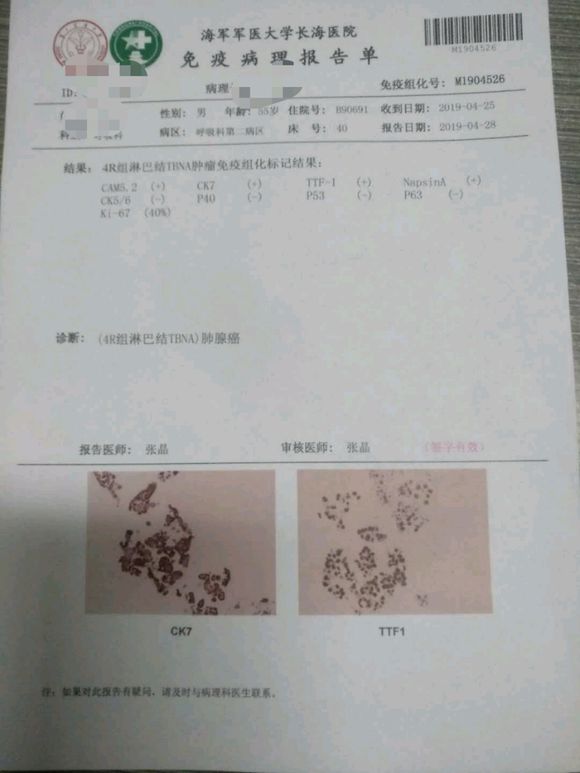 肺腺癌晚期有什么治疗方法