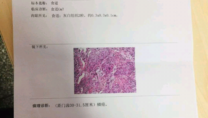 懂的老铁，能帮忙看看吗？