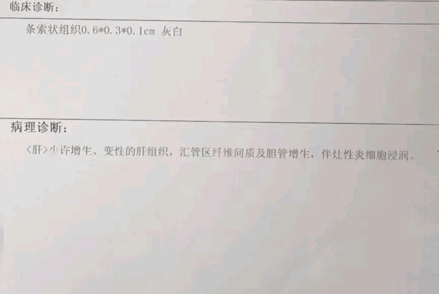 超声波穿刺结果