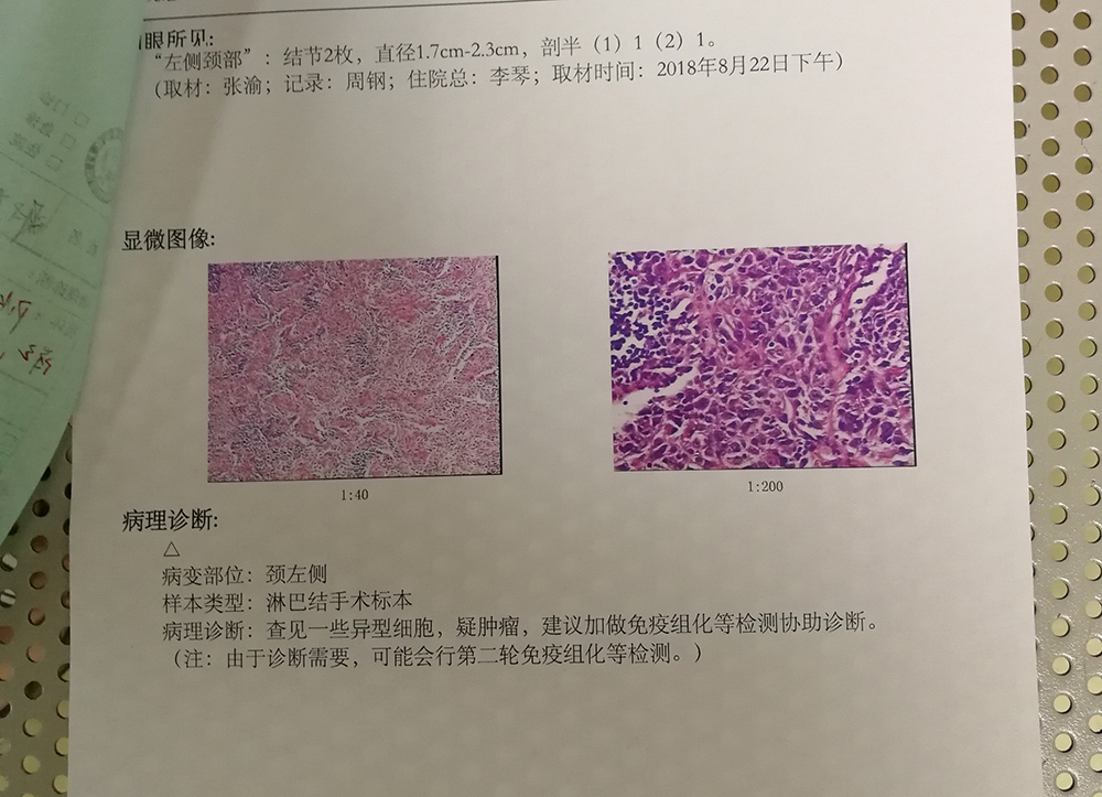 肺癌如果出现了颈部淋巴结转移一般人会有些什么症状？