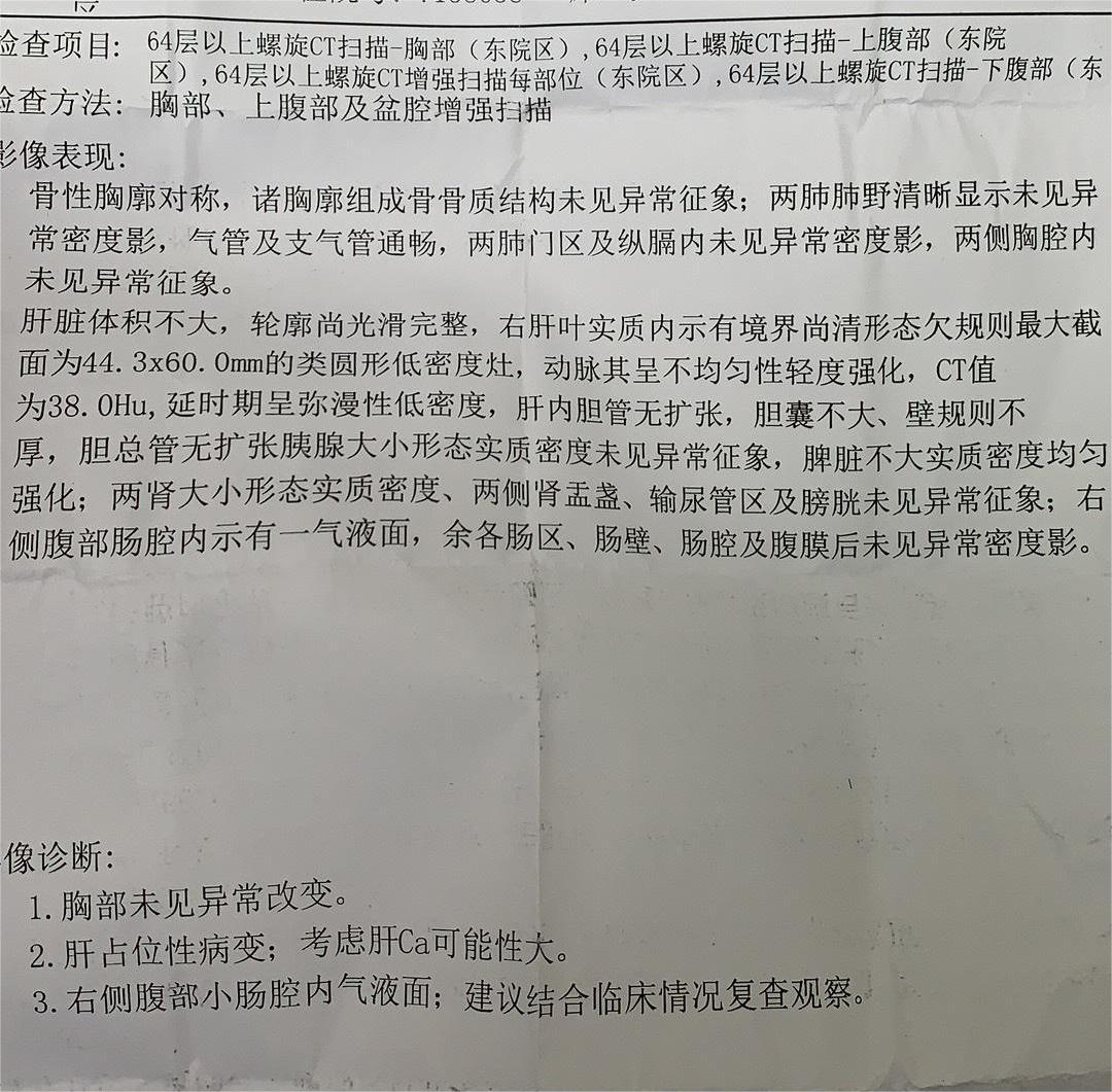 我爸的ct结果