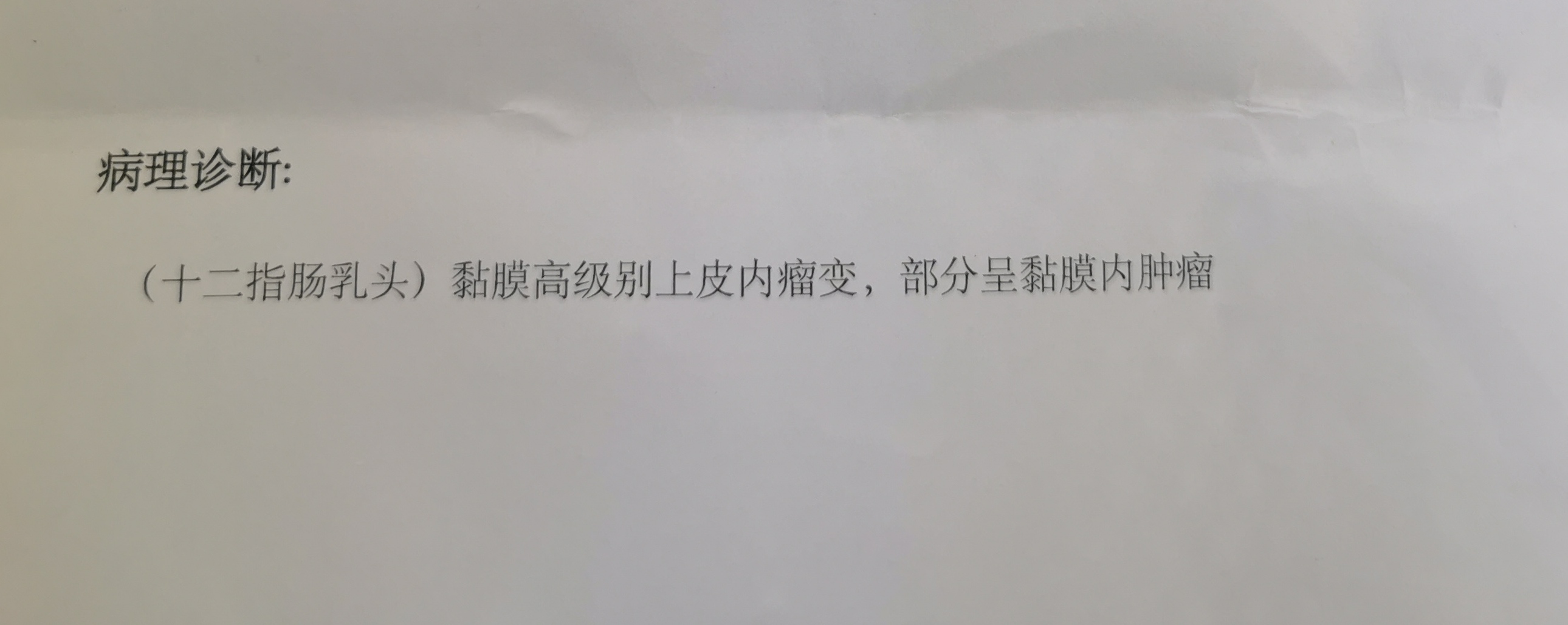 咨询，这是什么意思