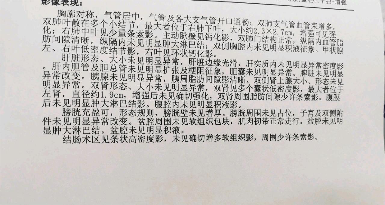 结肠癌术后一年增强CT结果，医生诊断为肺转移