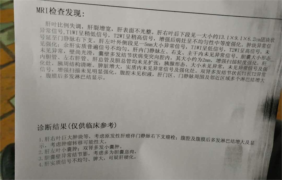 下午刚出的核磁共振结论，有专业人士吗帮我看看