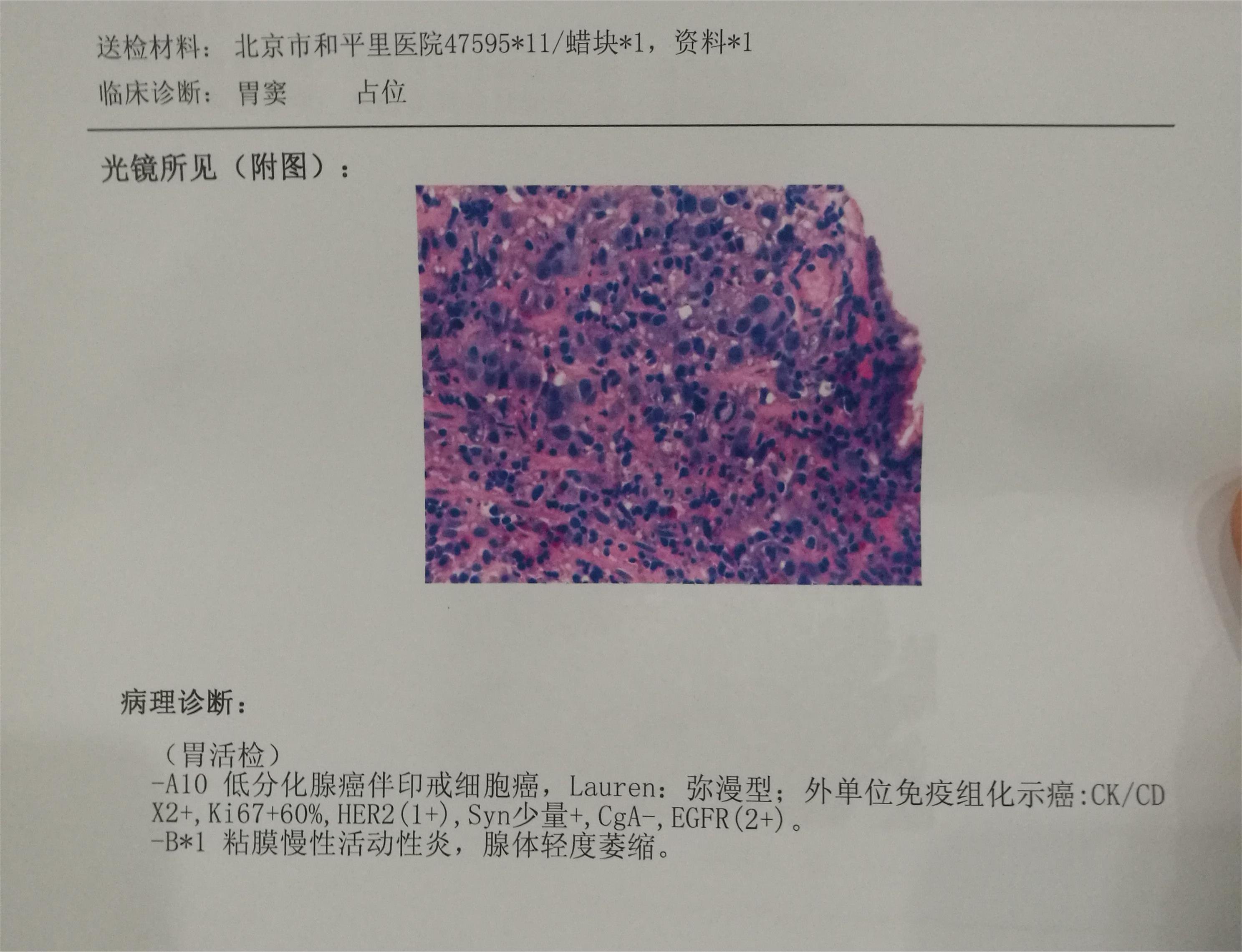 请大家帮我看看，这算什么程度了