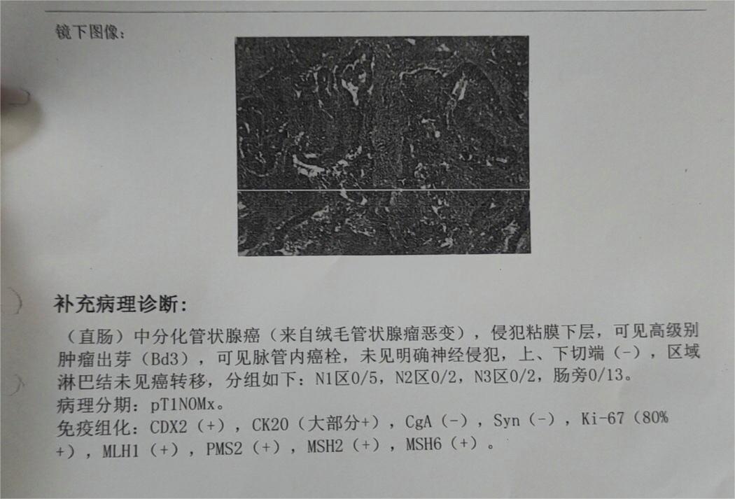 帮忙看看需要化疗吗