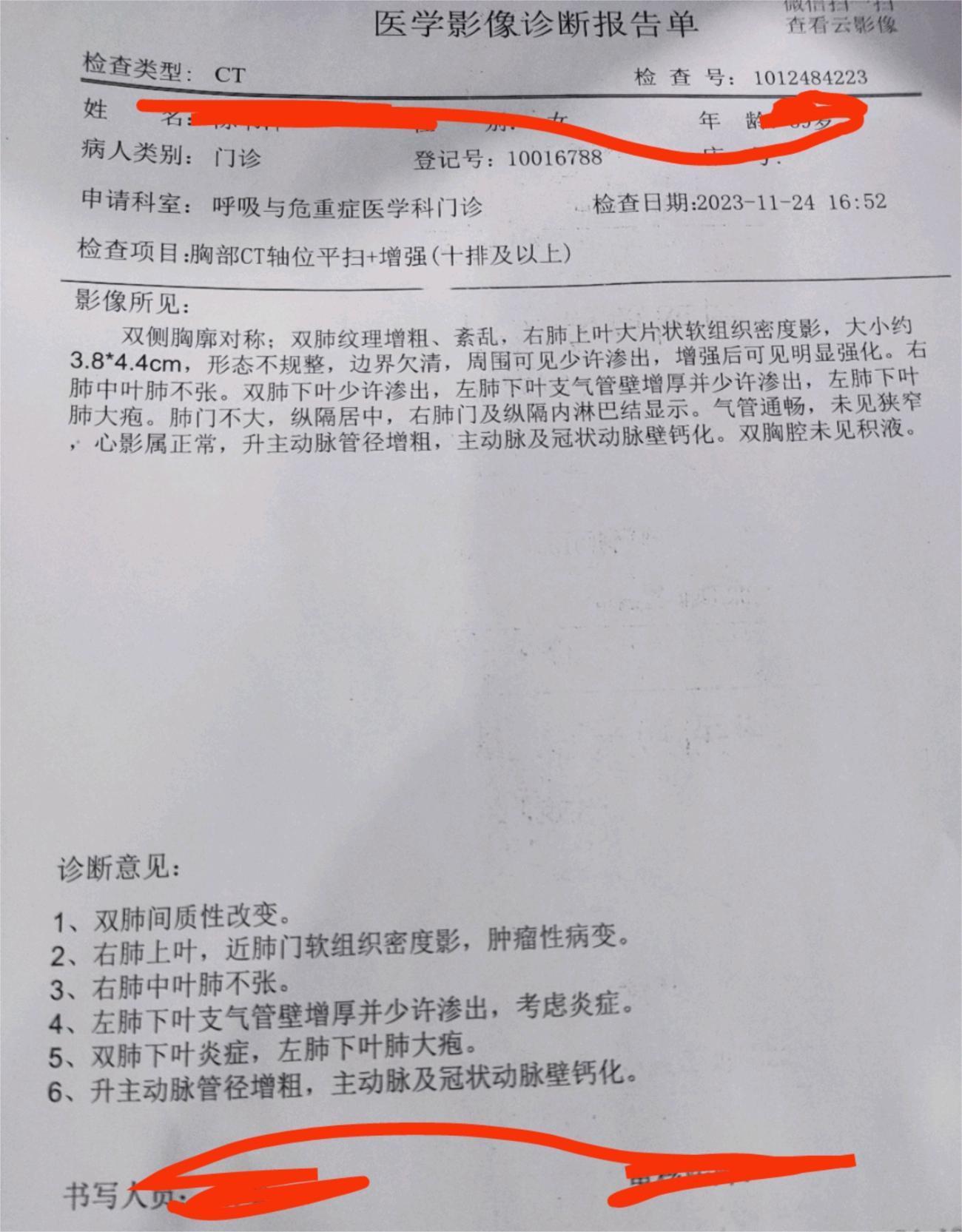 为什么癌症这么多？